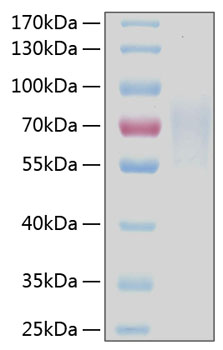 Recombinant human cd30/tnfrsf8 protein 100 µg