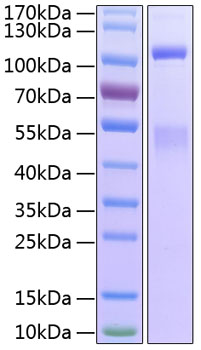 Recombinant human igf1r protein 100 µg