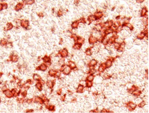 Aec substrate kit 1 x 500 tests