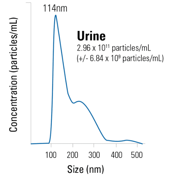 Purified exosomes from human urine (healthy donors)25 µg 25 µg
