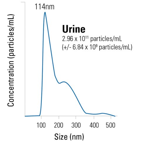 Purified exosomes from human urine (healthy donors)25 µg 25 µg