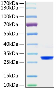 Recombinant mouse c-reactive protei n/crp protein 20 µg
