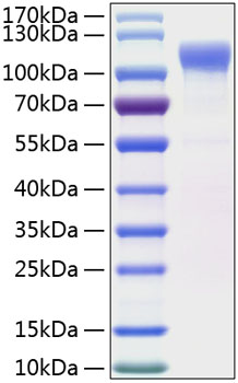 Recombinant human lrrc4 protein 50 µg