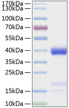 Recombinant human azu1/azurocidin 1 /cap37 protein 20 µg