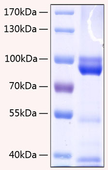 Recombinant human ager/rage protein 20 µg