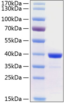 Recombinant human arginase protein 20 µg