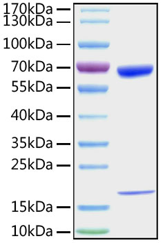 Recombinant mouse pcsk9 protein 10 µg