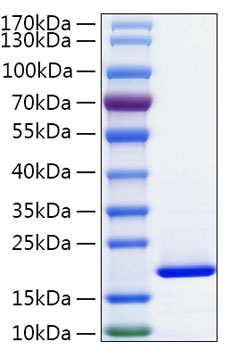 Recombinant human fabp2 protein (fa bpi, i-fabp) p12104 1000 µg