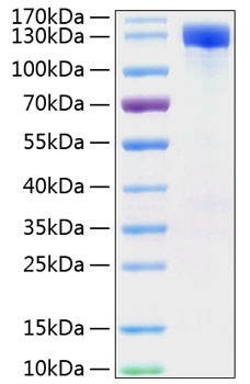 Recombinant mouse her2/erbb2 protei n (cd340,c-erbb2,c-neu,erbb-2,her-2,her2,neu) p70424 50 µg