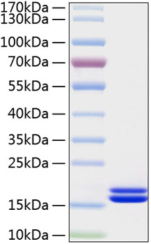 Recombinant human il2 protein 50 µg