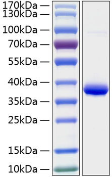Recombinant human igfbp-2 protein 100 µg