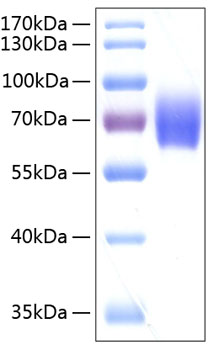 Recombinant human serpin f2/serpinf 2 protein 100 µg