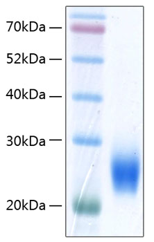 Recombinant human ulbp-2 protein 50 µg