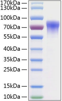 Recombinant human gfra2/gfr Alpha2/gdnfrb protein 100 µg