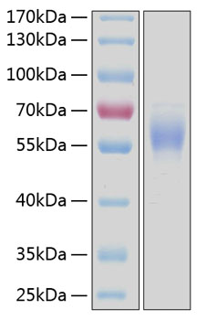Recombinant human ddr2 kinase/cd167 b kinase/cd167bprotein 100 µg
