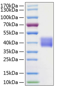 Recombinant human kallikrein 1 protein 10 µg
