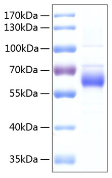 Recombinant human fgf r5/fgfrl1 pro tein 50 µg