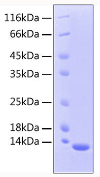 Recombinant human tgf-beta 2/tgfb2 protein 1000 µg