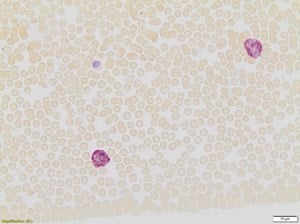 Naphthol AS-D Chloroacetate (Specific Esterase) Kit, 1 kit