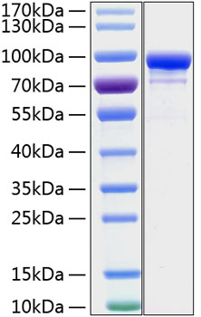 Recombinant human stat1 protein (si gnal transducerand activator of transcription 1-alpha/beta,trans 20 µg
