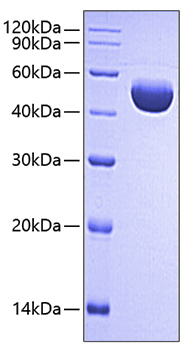 Recombinant human serpin e1 protein 1000 µg