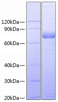 Recombinant human sirpg/sirpb2 prot ein 1000 µg