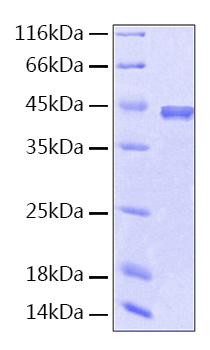 Recombinant human serpin f1 protein 100 µg