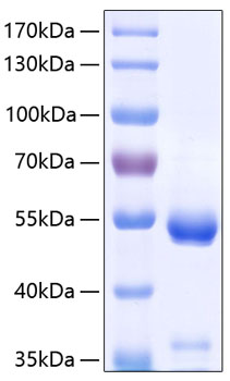 Recombinant human carboxypeptidase e protein 50 µg