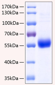 Recombinant human osteoprotegerin/tnfrsf11b protein 100 µg