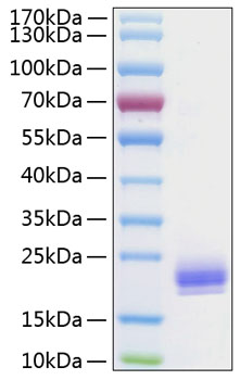 Recombinant human lair2 protein 20 µg
