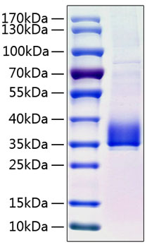 Recombinant human angptl3/angiopoie tin-like 3 protein 10 µg