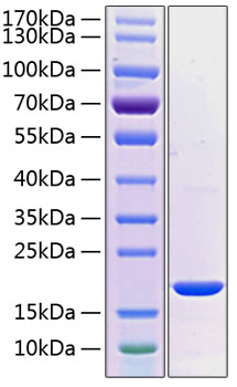 Recombinant human prl2 protein (hh1 3, hh7-2, hu-pp-1, ov-1, prl-2, prl2, ptp4a, ptpcaax2, ptp-iv1a, 1000 µg