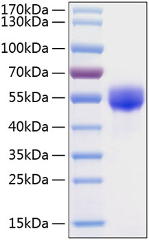 Recombinant human fetuin-a/ahsg/fet ua protein 10 µg