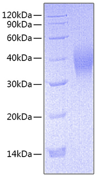 Recombinant mouse fc i riiia/fcgr3 /cd16 protein 10 µg