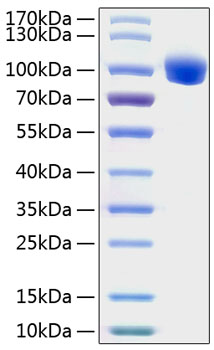 Recombinant human ror1 protein 20 µg