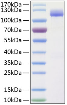 Recombinant human alcam/cd166 prote in 20 µg