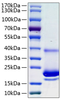 Recombinant human il-4 protein 20 µg