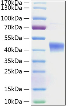 Recombinant human il-22bp/il-22ra2 protein 20 µg