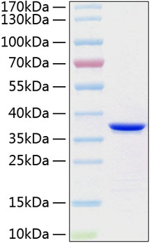 Recombinant human annexin a5/annexi n v/anxa5 protein 20 µg
