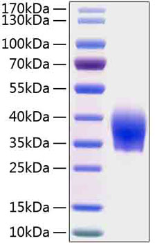 Recombinant human slamf6 protein (c d352, kali, kalib, ly108, ntb-a, ntba, sf2000) q96du3 1000 µg