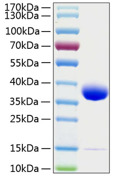 Recombinant human prlr/prolactin re ceptor protein 10 µg