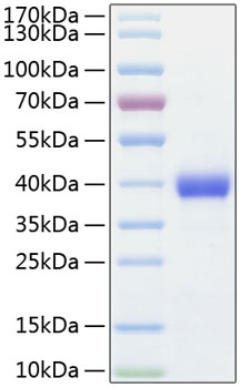 Recombinant human antxr1 protein 50 µg