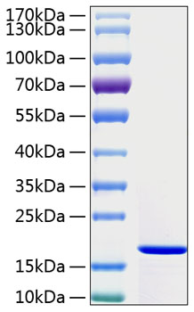 Recombinant human interferon gamma protein 50 µg
