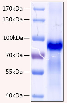 Recombinant human granulin/grn/prog ranulin protein 20 µg