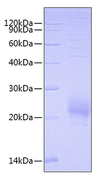 Recombinant human cd160 protein 50 µg