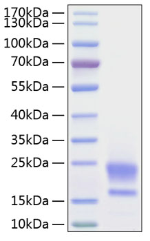 Recombinant human wap5/wfdc2/he4 pr otein 20 µg