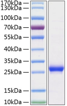 Recombinant rat lipocalin-2/ngal pr otein 500 µg