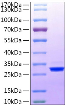 Recombinant human btn3a3 protein (b tf3, btn3.3) o00478 10 µg