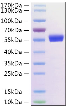 Recombinant human ror2 protein (bdb , bdb1, ntrkr2)q01974 1000 µg