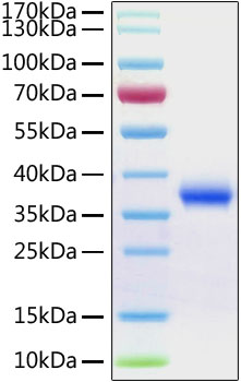 Recombinant sars-cov-2 spike rbd pr otein with his tag (s1-rbd protein,ncp-cov rbd protein,novel coro 100 µg